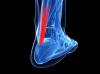 injury X-ray image