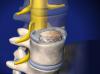 Image of Anterior Lumbar Interbody Fusion