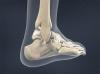 ankle sprain image