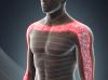 Cervical radiculopathy image