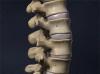 Anatomy of the Spine image