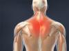 image of Muscle Strain of the Upper Back